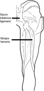 Hamstring fascial connection to sacrotuberous ligament